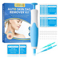 2-in-1 Skin Tag Remover Kit – Painless Wart & Mole Tool Skin Tag Remover Oasis Select Blue spain