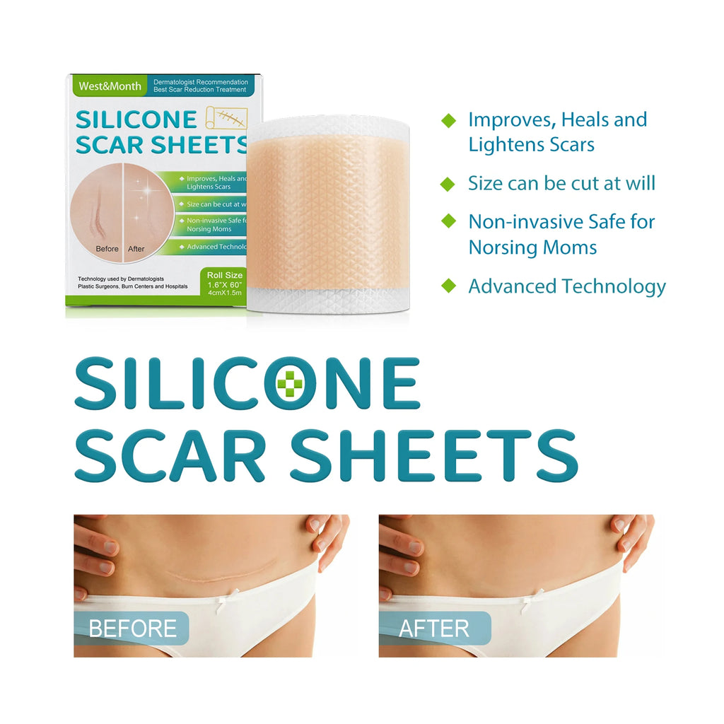 Silicone Scar Sheets Roll 4cm×150cm | Self-Adhesive Scar Tape Silicone Scar Tape Oasis Select