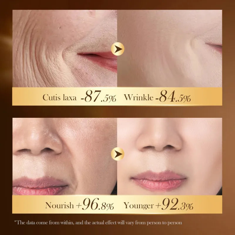 SADOER Caviar DNA Sodium Collagen Frming Cream for Moisturizing Nourish Anti-age Skin Care 30g Oasis Select