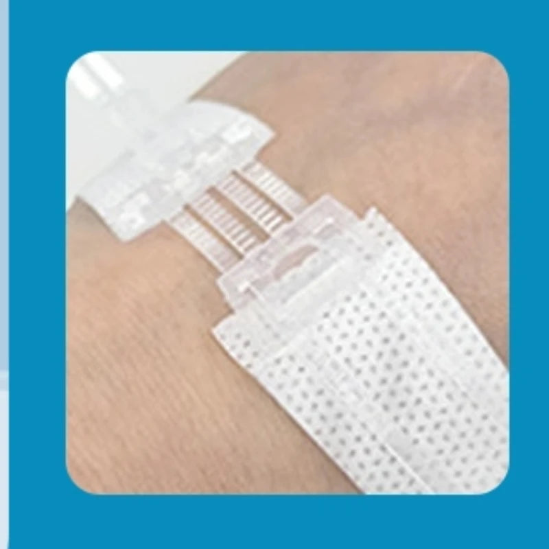 Zipper Wound Closure Strips | No-Suture Fast Closure Patch