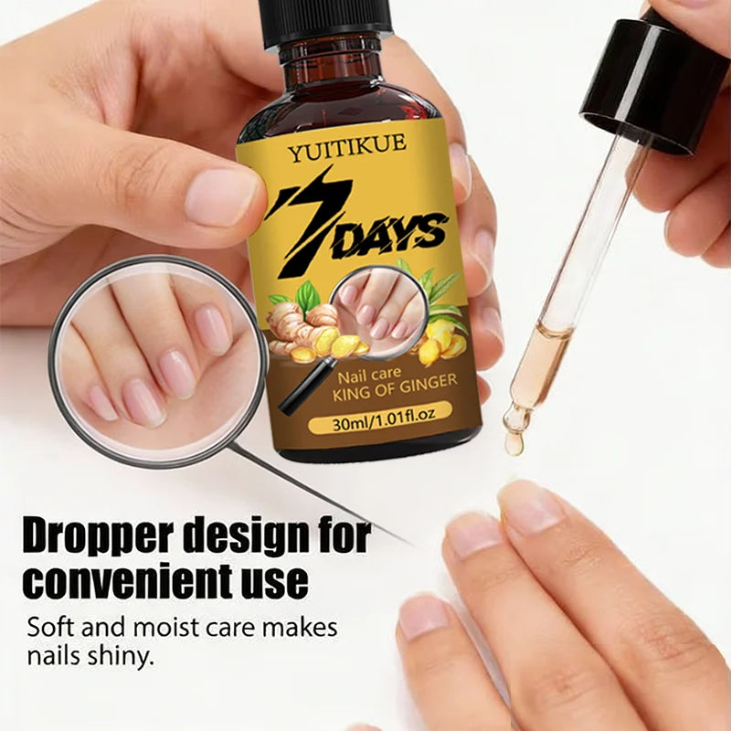 Ginger Nail Care Oil – Nourish, Strengthen & Shine 30ml