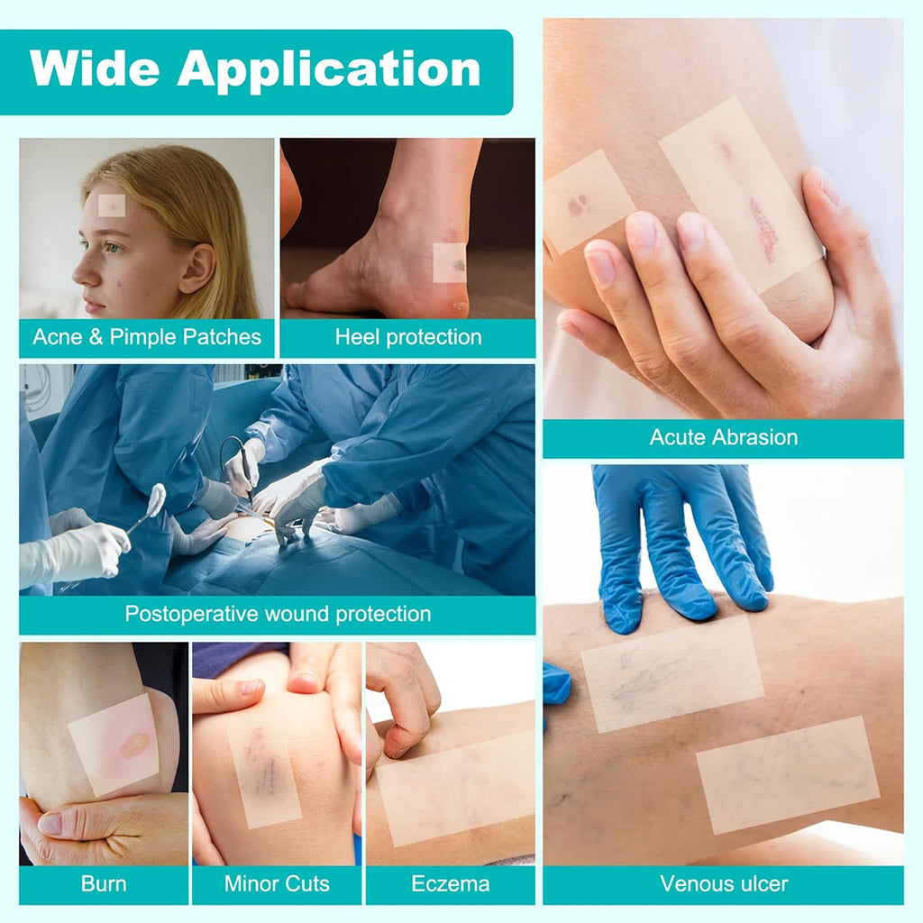 Hydrocolloid Patch Large Bandages with Self-Adhesive, 1/2/3PCS Hydrocolloid Roll for Wound Care,Absorbent, Flexible, Waterproof Oasis Select