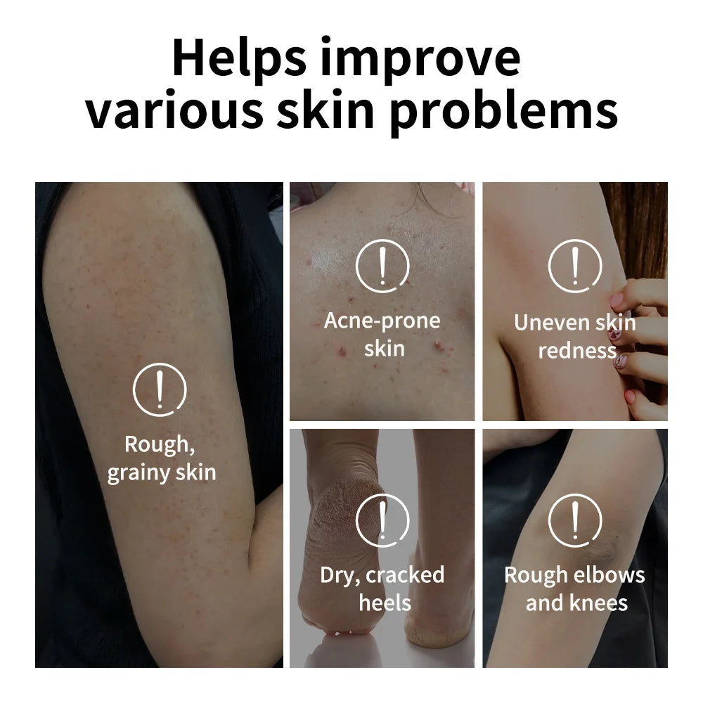 Glycolic Acid Exfoliating Body Stick Smooth Soften Rough Bumpy Skin Deep Hydration Even Delicate Skin Tone Exfoliating Stick Oasis Select