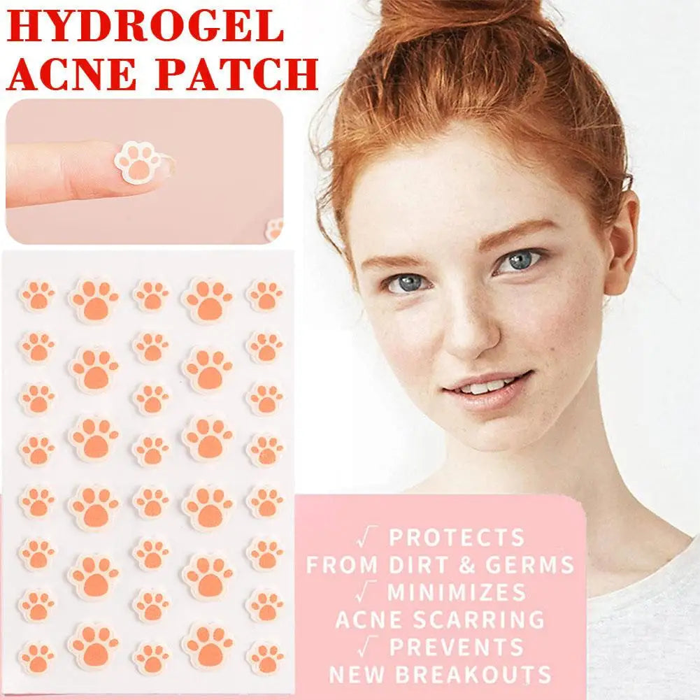 Cat Paw Hydrocolloid Acne Patches – 36 Invisible Pimple Dots Acne Pimple Patch Oasis Select