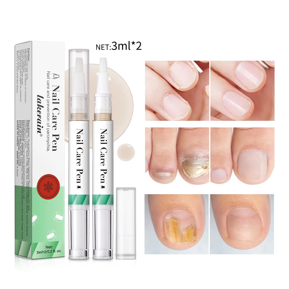 Nail Growth Cuticle Oil Pen – 2-Pack Nail Treatment | ibcccndc Nail Treatment Oil Oasis Select