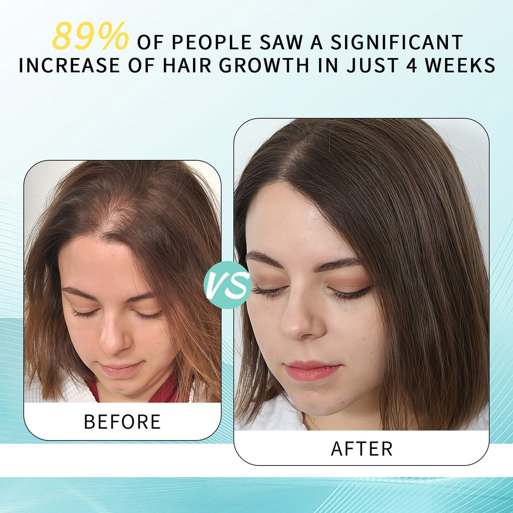 Lavender Hair Growth Oil Treatment – Moisturizing, Anti-Frizz Hair Treatment Oil Oasis Select