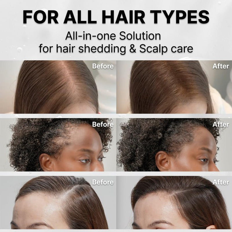 Hair Nourishing Essence with Built-In Brush Head – 100ml Hair Nourishing Essence Oasis Select
